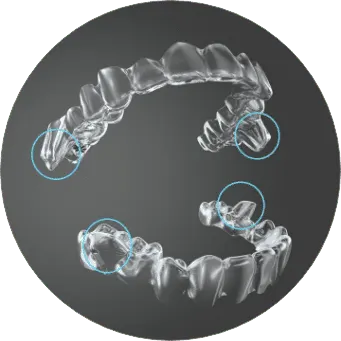 Mandibular Advancement