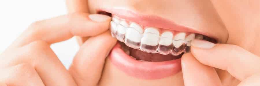 Retainers