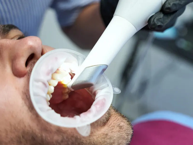 dental laser