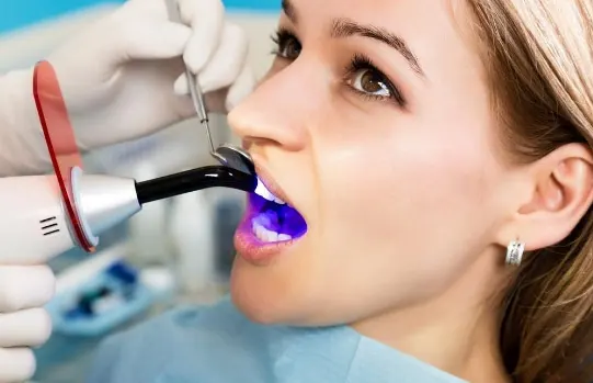 Fillings