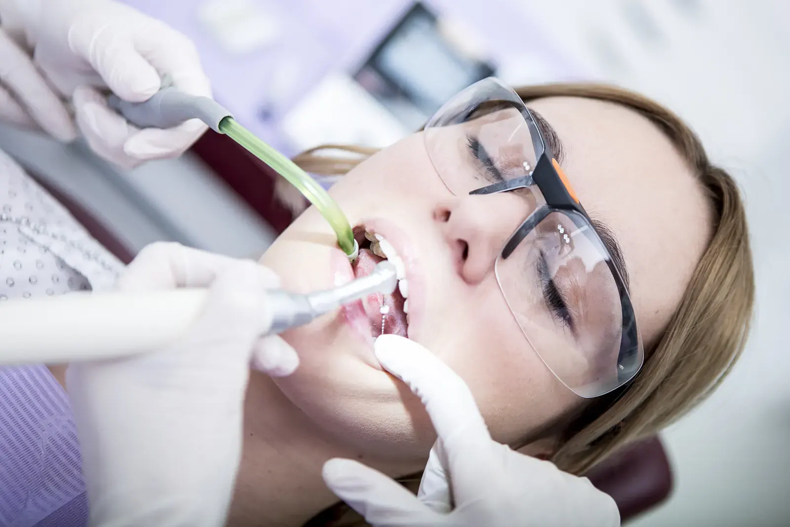 root canal side copy