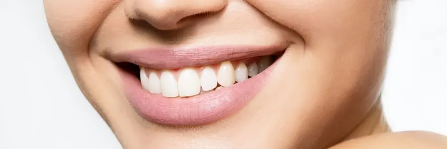 Teeth Whitening