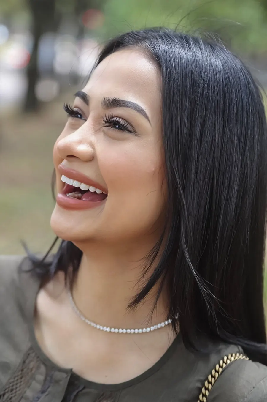 veneers-_1